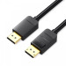 Vention Кабель Vention DisplayPort - DisplayPort (M/M), 1 м, чорний (HACBF)