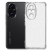 BeCover Чохол до мобільного телефона BeCover Anti-Shock Honor 200 Clear (714953)